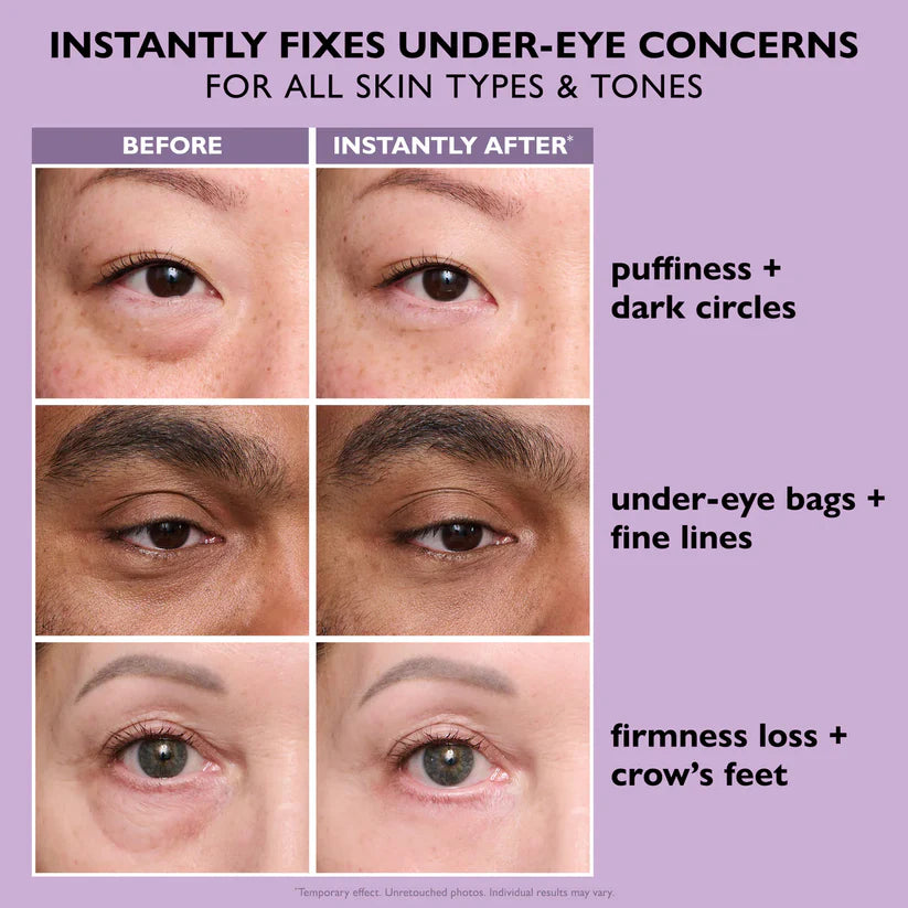 Herblix™ Eye Tightener