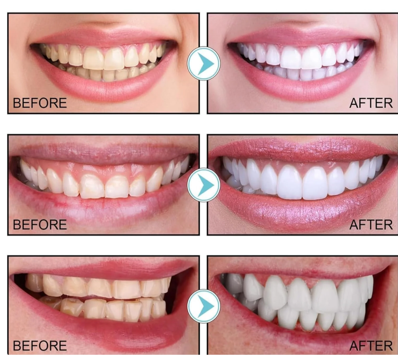 Herblix™ Niacinamide Whitening Toothpaste