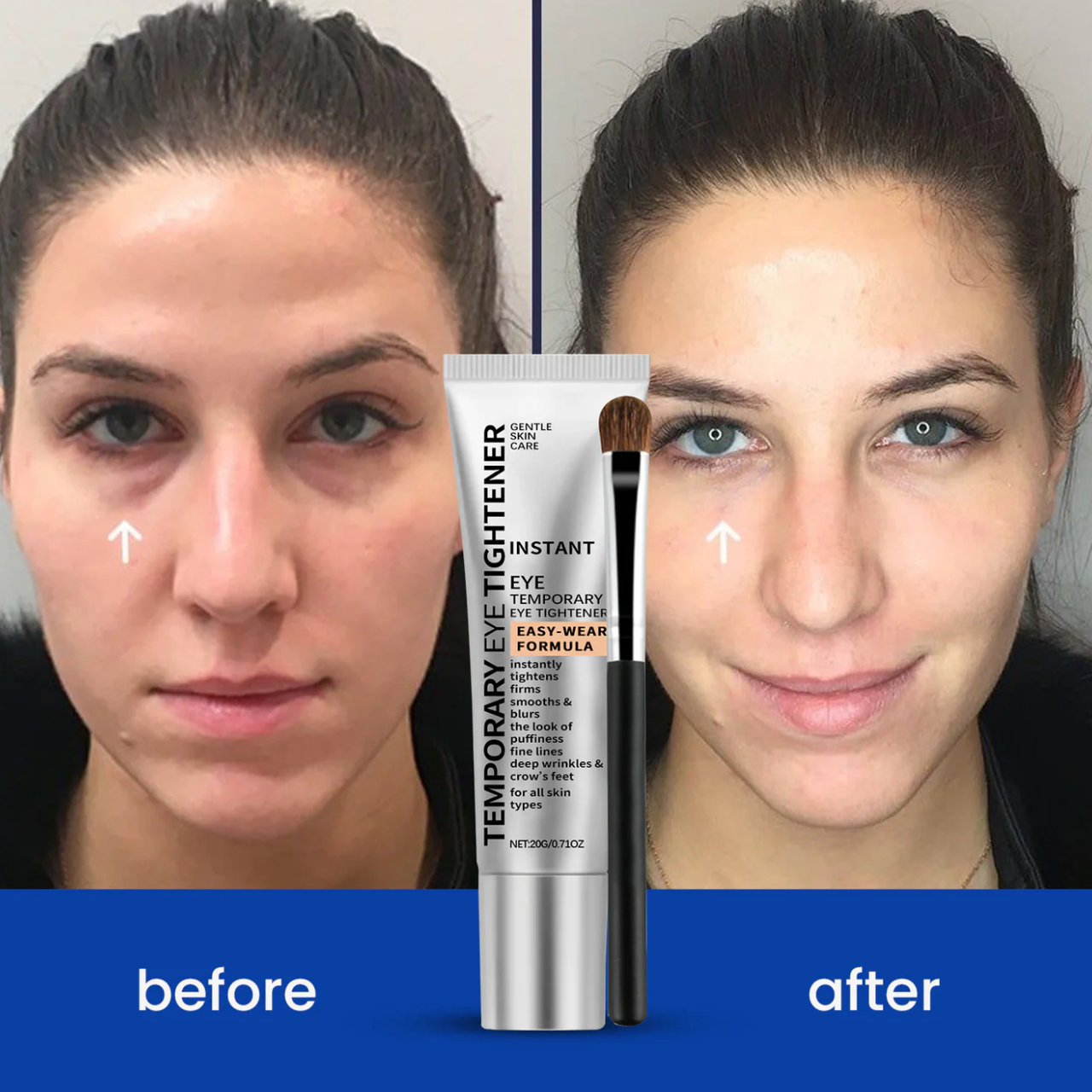 Herblix™ Eye Tightener